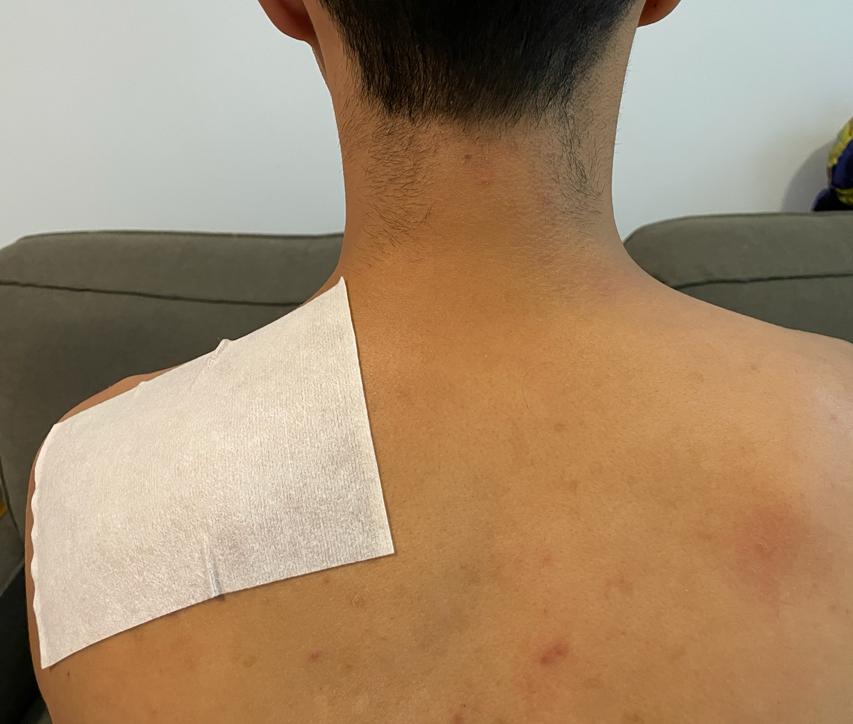 健之堂艾草 UCII 熱灸止痛貼使用男士肩胛